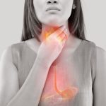 Rendering of how GERD causes discomfort